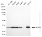 KD-Validated Anti-AKR1B1 Mouse Monoclonal Antibody